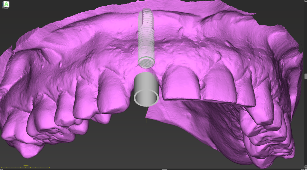 3D-Modell eines Oberkiefers