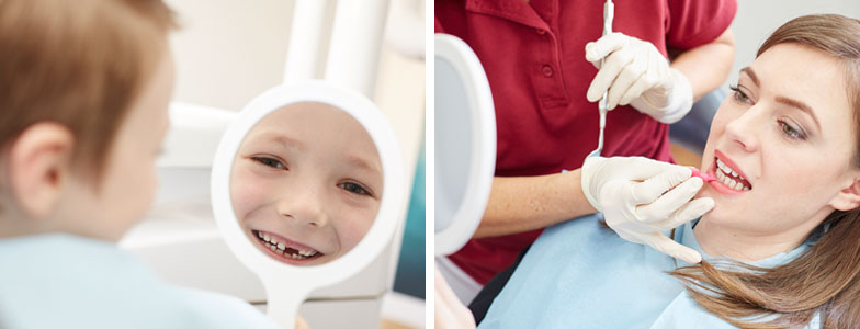 Eine Kollage aus zwei Bildern. Auf der linken Seite betrachtet ein Kind seine Zahnlücke im Handspiegel, auf der rechten Seite betrachtet sich eine Patientin im Handspiegel, während ihre Zahnzwischenräume mit einem Interdentalstick gereinigt werden.